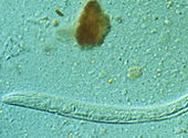Strongyloides stercoralis 