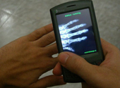 Radiografie
