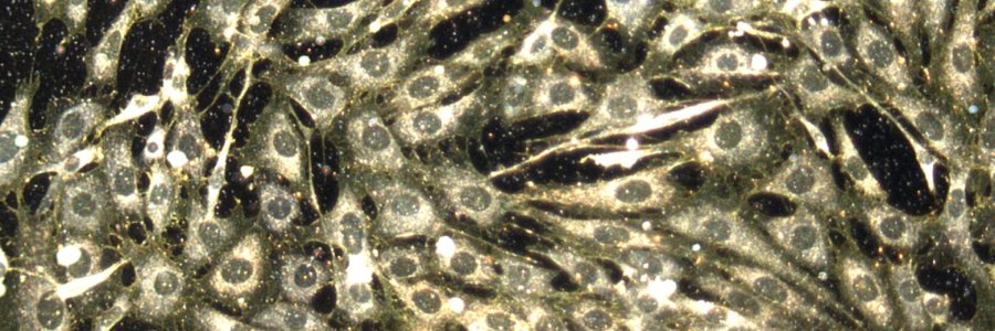 Nanoparticule - livrare medicamente în organism