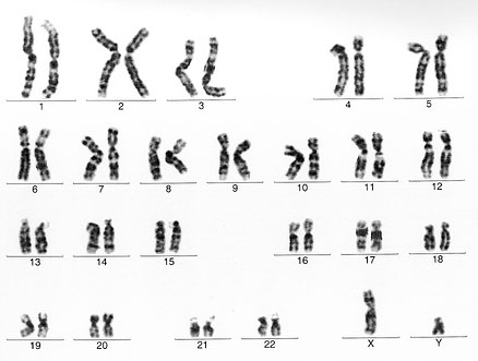 Cromozomi