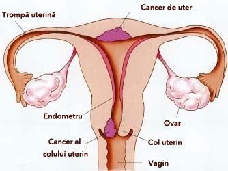 localizare cervix