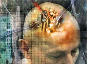 Implant creier